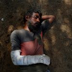 Bullets & Burns: Photos Reveal Rohingya Suffering - About Islam