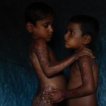 Bullets & Burns: Photos Reveal Rohingya Suffering - About Islam