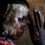 Bullets & Burns: Photos Reveal Rohingya Suffering - About Islam