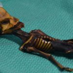 Atacama Desert Mummy Found in to Be Tiny, Mutated Child