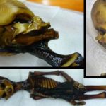 Atacama Desert Mummy Found in to Be Tiny, Mutated Child