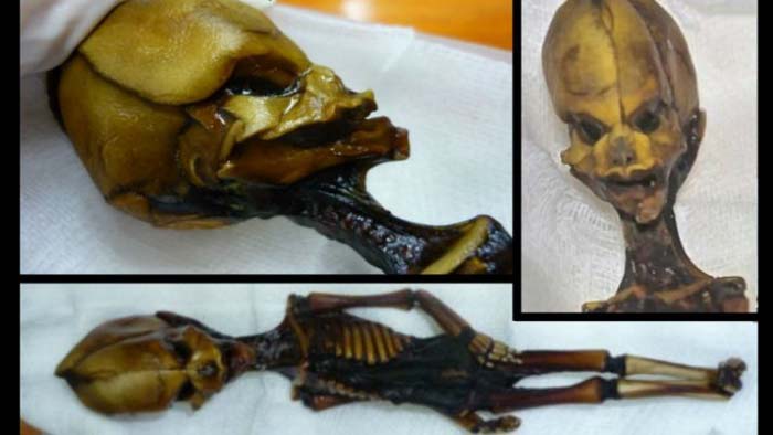 Atacama Desert Mummy Found in to Be Tiny, Mutated Child