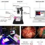 Glowing Chemical Can Aid Brain Cancer Surgery - About Islam